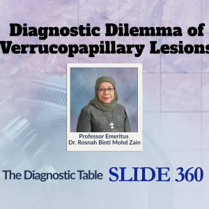 The Diagnostic Table – SLIDE 360 | Diagnostic Dilemma of Verrucopapillary Lesions
